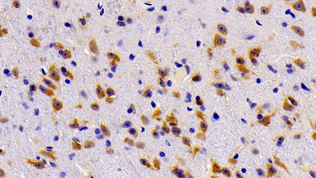 ABCA8 Antibody in Immunohistochemistry (Paraffin) (IHC (P))