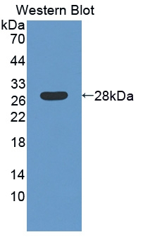 Laminin beta-4 Antibody in Western Blot (WB)