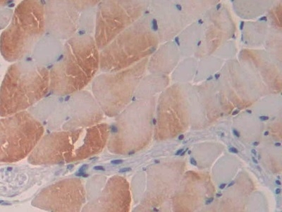 Profilin 3 Antibody in Immunohistochemistry (Paraffin) (IHC (P))