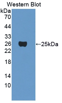 CRYGF Antibody in Western Blot (WB)