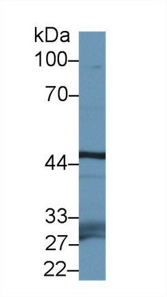 FBXL3 Antibody in Western Blot (WB)