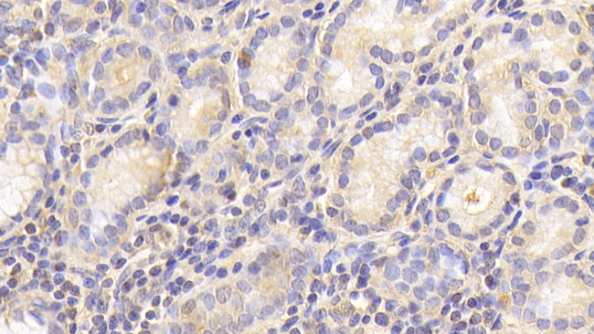 Cathepsin O Antibody in Immunohistochemistry (Paraffin) (IHC (P))