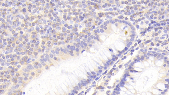 NKG2C Antibody in Immunohistochemistry (Paraffin) (IHC (P))