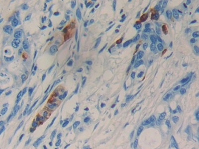LCN15 Antibody in Immunohistochemistry (Paraffin) (IHC (P))