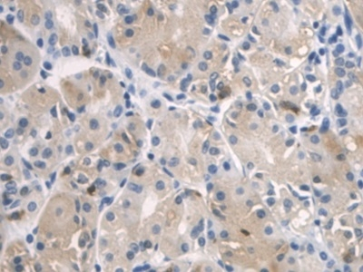 SPRY2 Antibody in Immunohistochemistry (Paraffin) (IHC (P))
