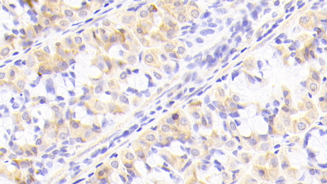 NUP205 Antibody in Immunohistochemistry (Paraffin) (IHC (P))