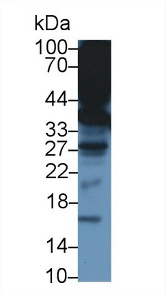 alpha TTP Antibody in Western Blot (WB)