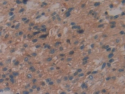 IL-29 Antibody in Immunohistochemistry (Paraffin) (IHC (P))