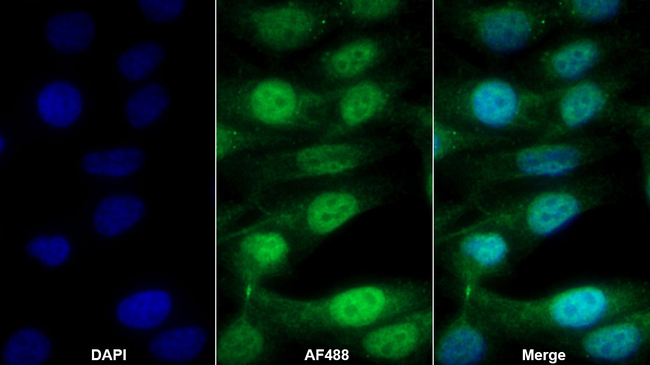 RelB Antibody in Immunocytochemistry (ICC/IF)