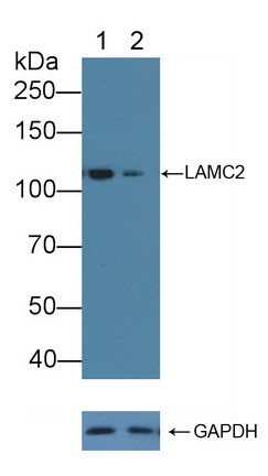 Laminin gamma-2 Antibody in Western Blot (WB)