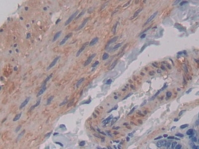 MIP-1 gamma Antibody in Immunohistochemistry (Paraffin) (IHC (P))