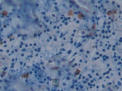 BOC Antibody in Immunohistochemistry (Paraffin) (IHC (P))