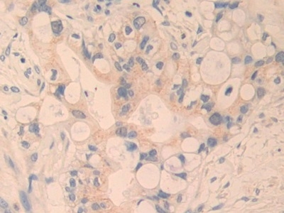 CYR61 Antibody in Immunohistochemistry (Paraffin) (IHC (P))