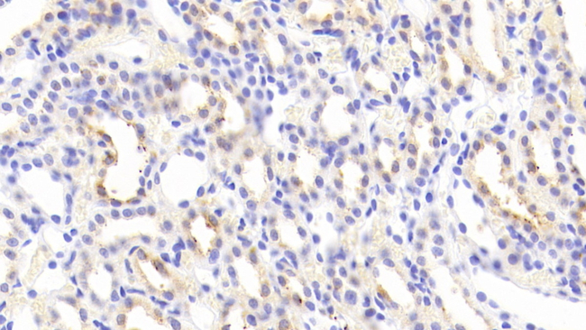 GAL3ST1 Antibody in Immunohistochemistry (Paraffin) (IHC (P))