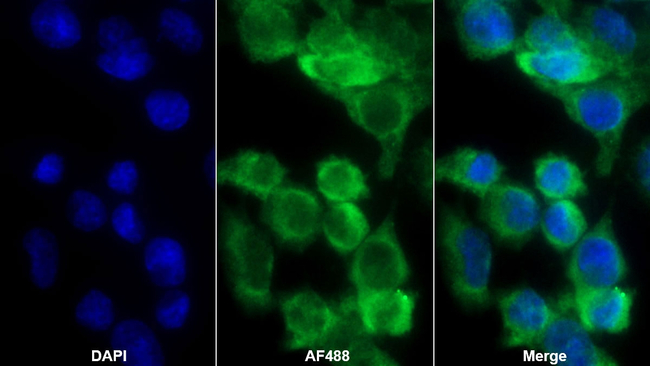 Complement C4b Antibody in Immunocytochemistry (ICC/IF)