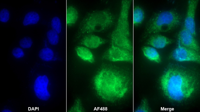 Midkine Antibody in Immunocytochemistry (ICC/IF)