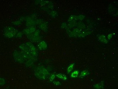 MCM2 Antibody in Immunocytochemistry (ICC/IF)