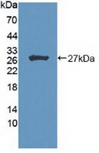 HIPK2 Antibody in Western Blot (WB)