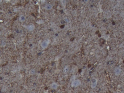 S100B Antibody in Immunohistochemistry (Paraffin) (IHC (P))