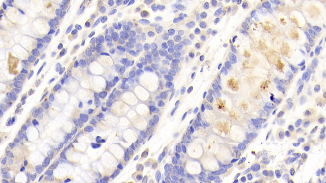 CHN2 Antibody in Immunohistochemistry (Paraffin) (IHC (P))