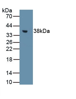 Metallothionein Antibody in Western Blot (WB)