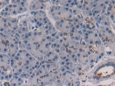IL-28A Antibody in Immunohistochemistry (Paraffin) (IHC (P))
