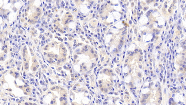 FLRT3 Antibody in Immunohistochemistry (Paraffin) (IHC (P))
