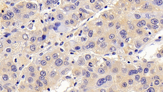 CCL16 Antibody in Immunohistochemistry (Paraffin) (IHC (P))
