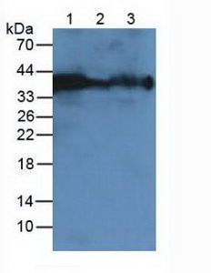 Carbonic Anhydrase XII Antibody in Western Blot (WB)