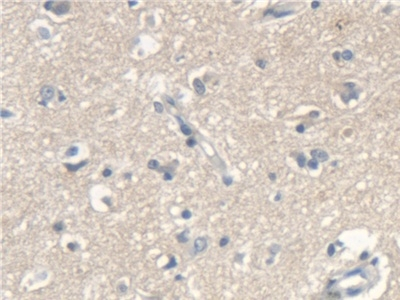 SCARA5 Antibody in Immunohistochemistry (Paraffin) (IHC (P))