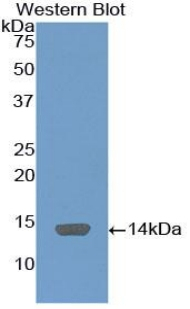 C4BPA Antibody in Western Blot (WB)