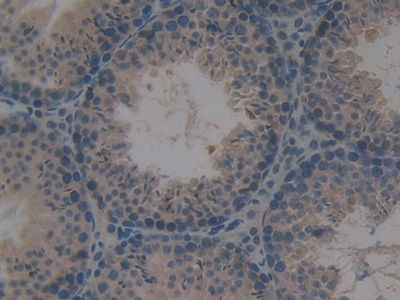 PRKD1 Antibody in Immunohistochemistry (Paraffin) (IHC (P))