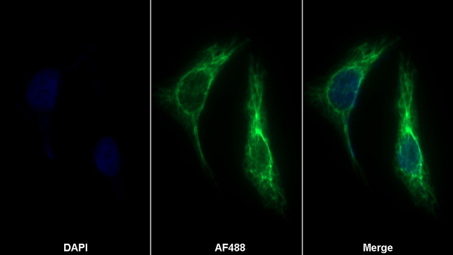 Renin Antibody in Immunocytochemistry (ICC/IF)