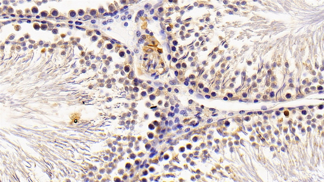 COMP Antibody in Immunohistochemistry (Paraffin) (IHC (P))