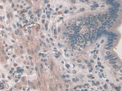 PDE12 Antibody in Immunohistochemistry (Paraffin) (IHC (P))