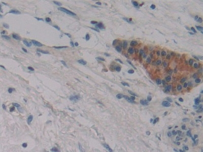 Fibrillin 3 Antibody in Immunohistochemistry (Paraffin) (IHC (P))