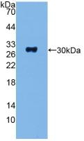 ADCY1 Antibody in Western Blot (WB)