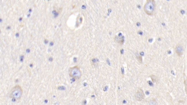 Resistin Antibody in Immunohistochemistry (Paraffin) (IHC (P))