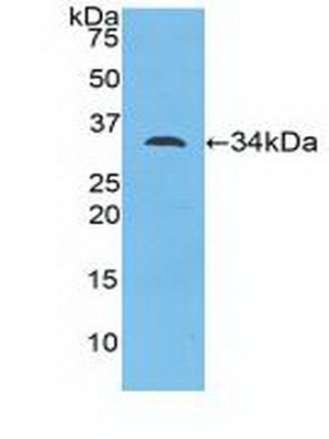 MYO1D Antibody in Western Blot (WB)