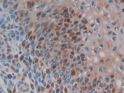 CCL3L1 Antibody in Immunohistochemistry (Paraffin) (IHC (P))