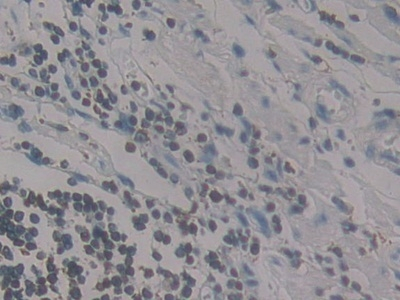 MCP-4 Antibody in Immunohistochemistry (Paraffin) (IHC (P))