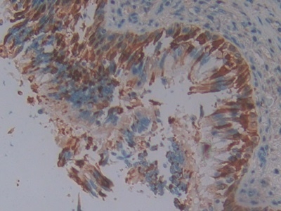 SERPINB3 Antibody in Immunohistochemistry (Paraffin) (IHC (P))