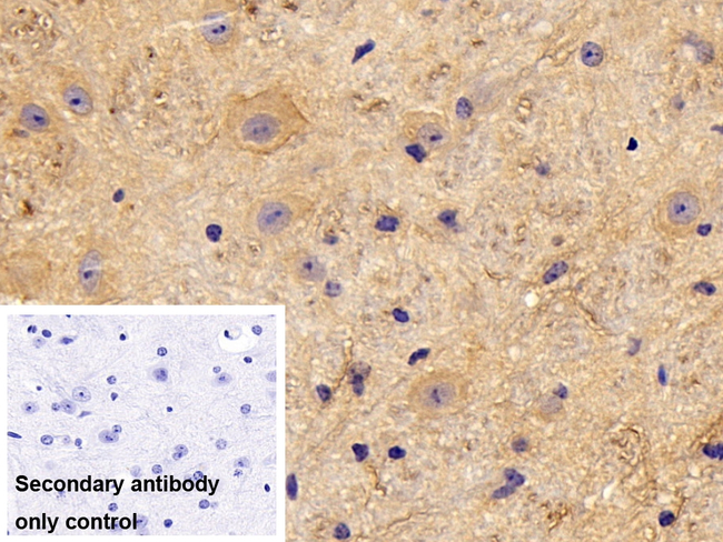 PKC alpha Antibody in Immunohistochemistry (Paraffin) (IHC (P))