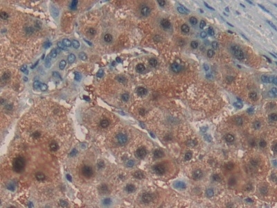 Laminin alpha-3 Antibody in Immunohistochemistry (Paraffin) (IHC (P))