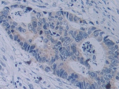 Neuropilin 2 Antibody in Immunohistochemistry (Paraffin) (IHC (P))