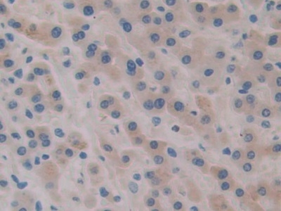 MYL9 Antibody in Immunohistochemistry (Paraffin) (IHC (P))