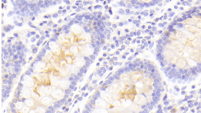 PLIN4 Antibody in Immunohistochemistry (Paraffin) (IHC (P))
