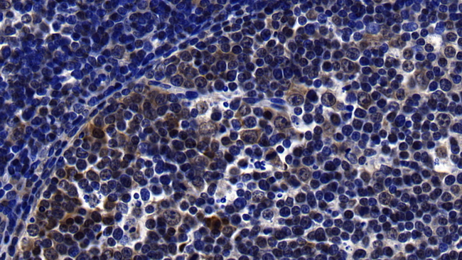LECT2 Antibody in Immunohistochemistry (Paraffin) (IHC (P))