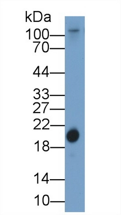 RBP4 Antibody in Western Blot (WB)