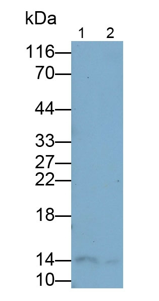 FABP1 Antibody in Western Blot (WB)